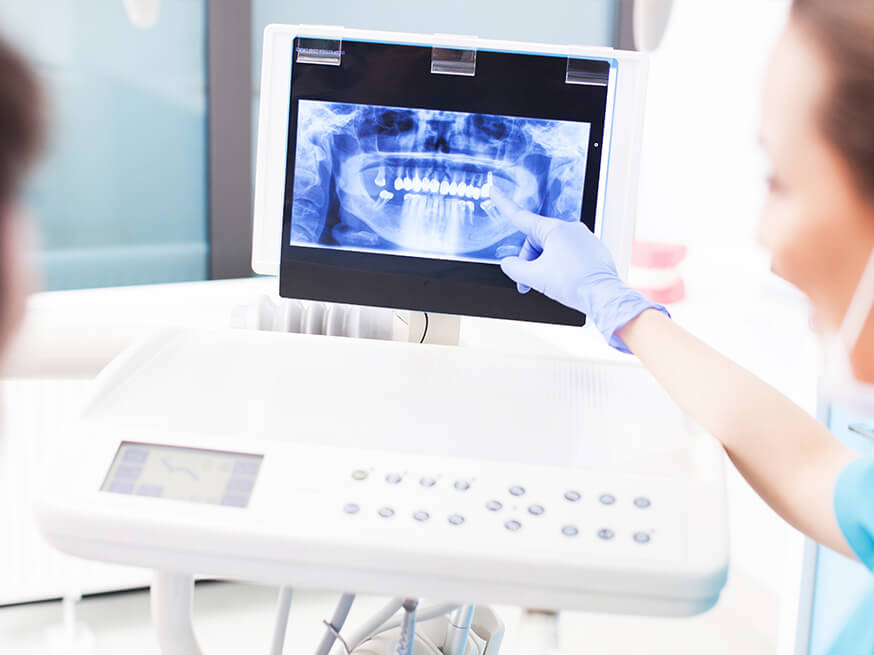 A thorough evaluation of your teeth will help us configure which implant fits best 