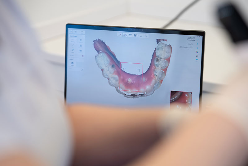 3d scan of patients teeth